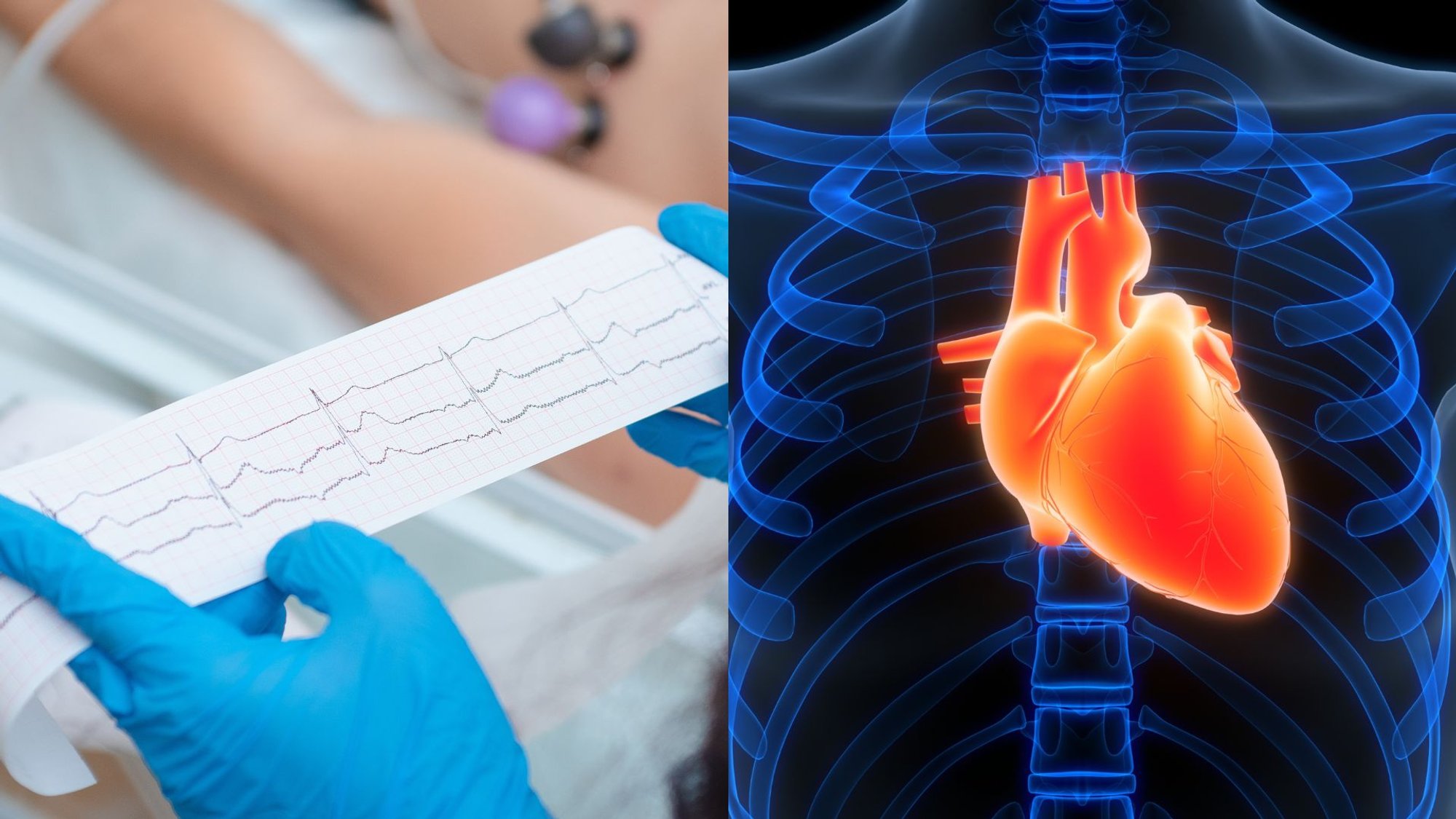 Nearly Everyone Experiences Heart Palpitations: Cardiologist Explains When to Worry
