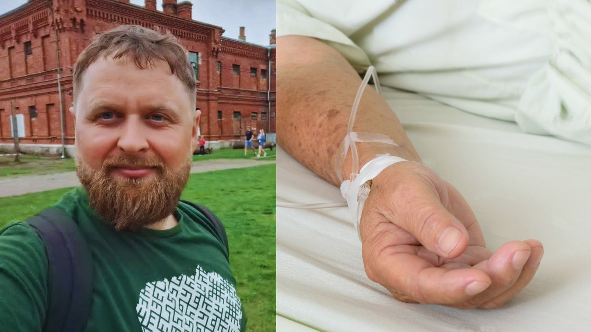 Man Thought He Had Flu, But Diagnosis Reveals Severe Tick-Borne Encephalitis