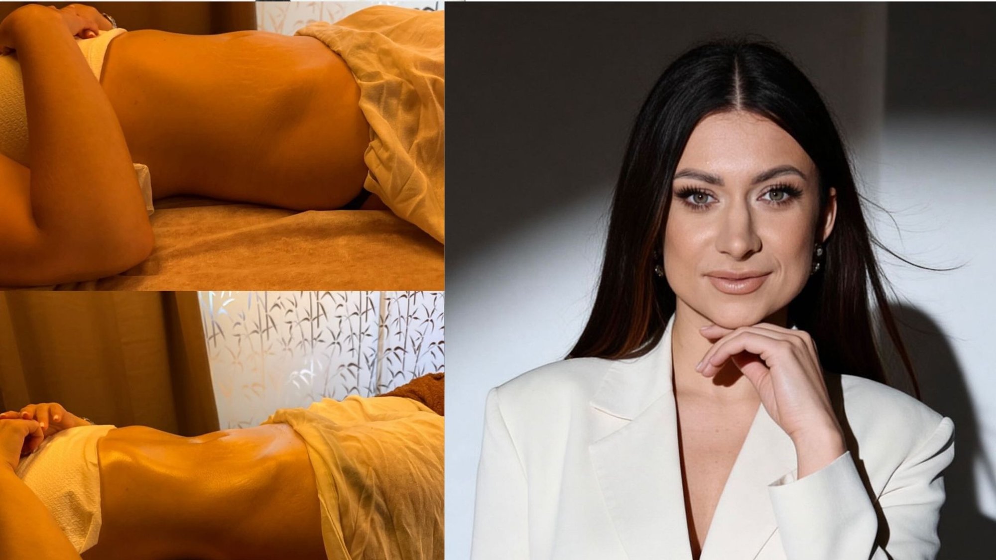 Lymphatic drainage massage results shown: Evaluate the 'before' and 'after'