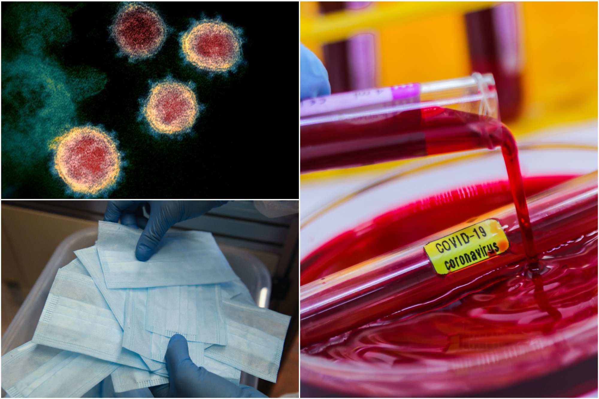 1st coronavirus case confirmed in Lithuania