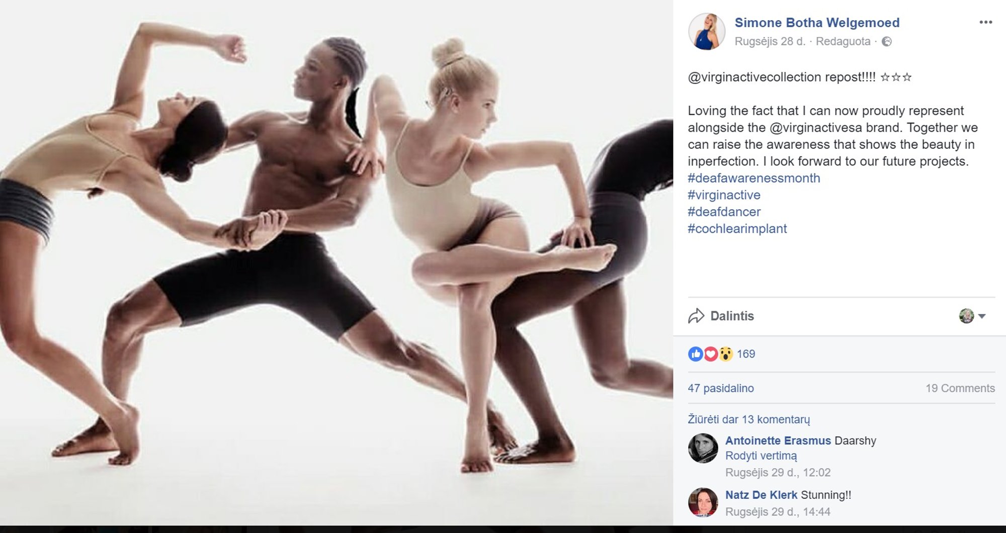 Balerina nustėro pamačiusi, ką jos nuotraukoje pakoregavo reklaminės ...