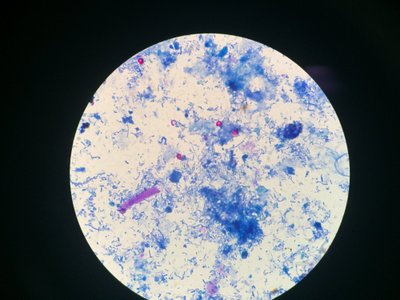 Cryptosporidium spp.