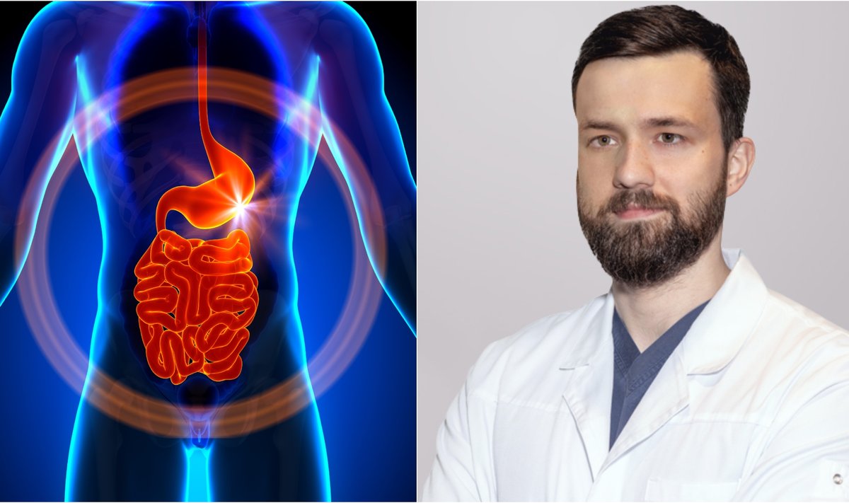 Gydytojas gastroenterologas endoskopuotojas Robertas Bundura papaskojo apie pavojingus virškinamojo trakto sutrikimus.