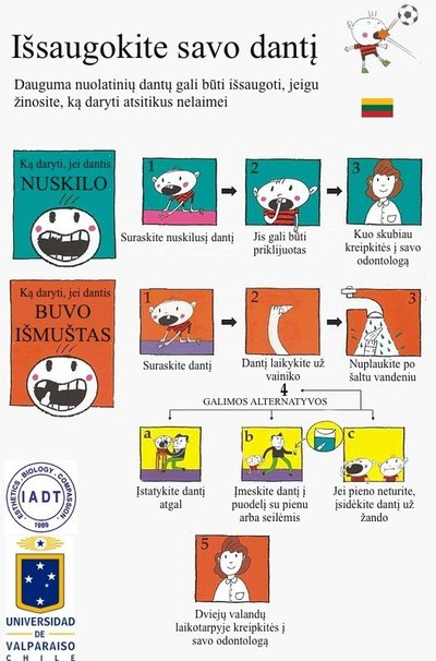 Kaip išsaugoti dantį?