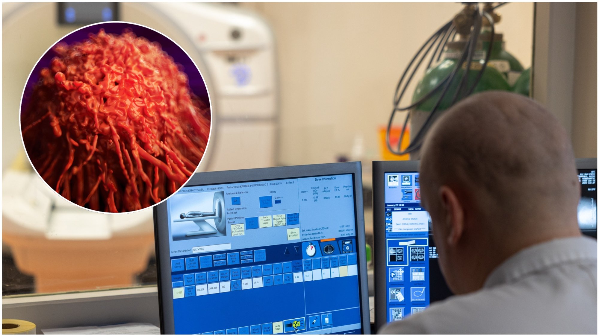 Common Habit May Increase Cancer Risk, Researcher Says