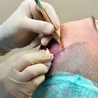 Врачи и юристы предупреждают в связи с излюбленными процедурами: возможно, придется обращаться в суд