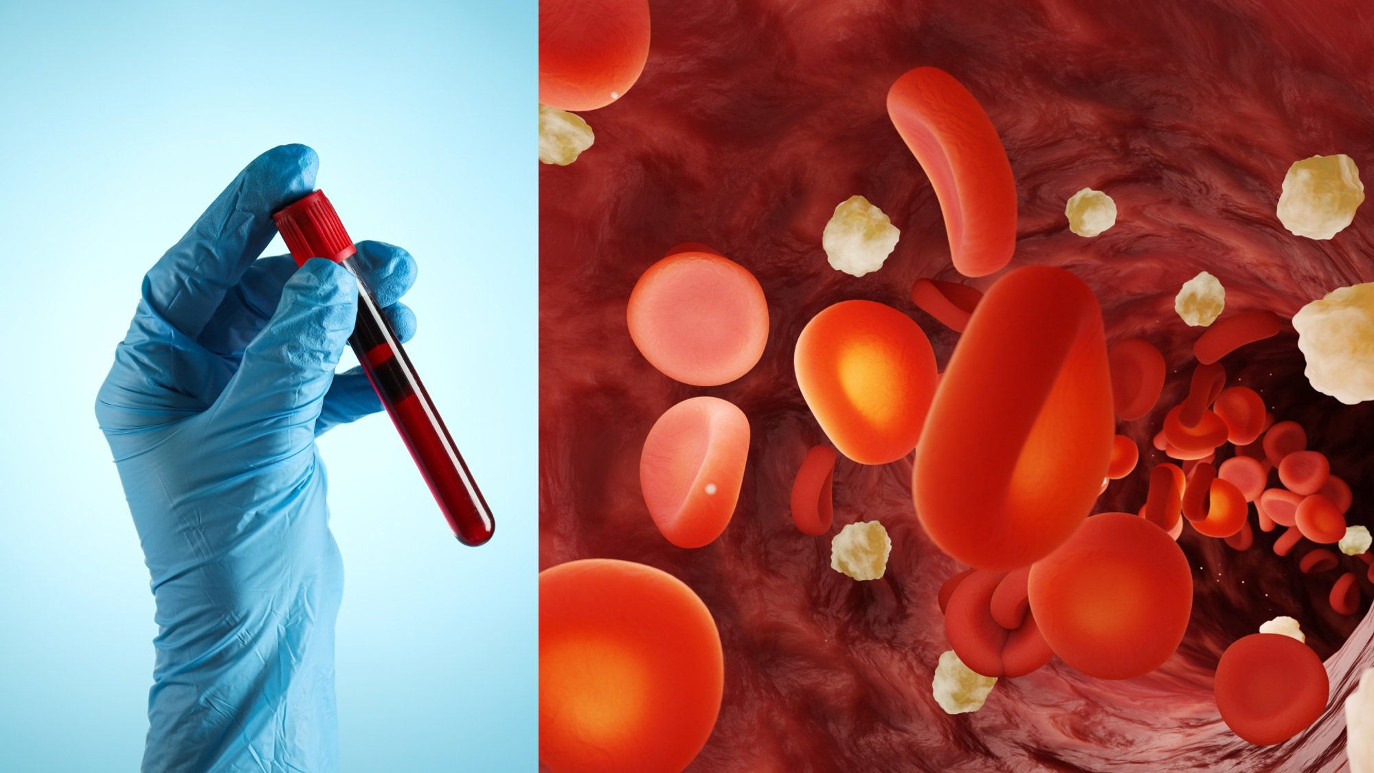 Unexpected Cholesterol Treatment Effect: Scientists Believe They Found a Lifesaver