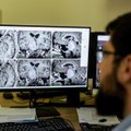 Nemaloni būklė neretai lydi Alzheimerio, Parkinsono ar kitas neurologines ligas: daktaras paaiškino, kodėl taip nutinka