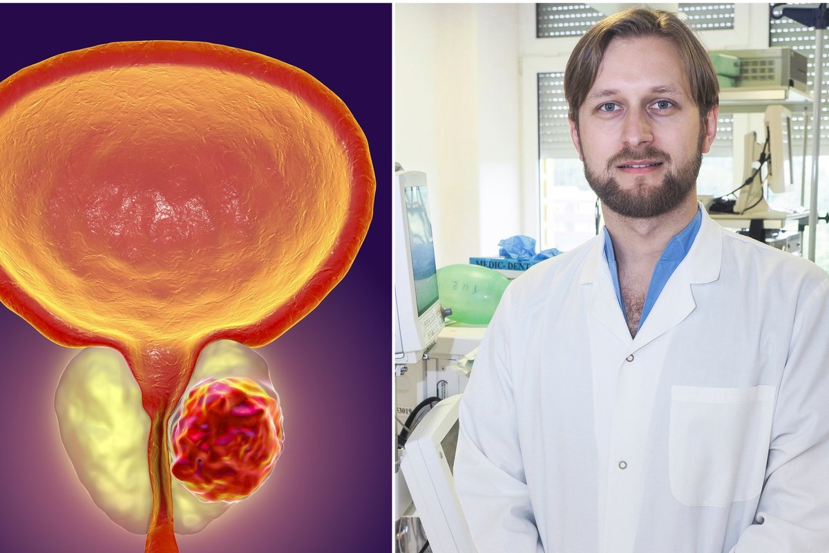 Daktaras įvardijo visuotinai priimtiną prostatos vėžio simptomą, kuris ...