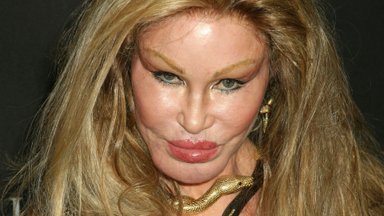 Parodė, kaip „moteris katė“ Jocelyn Wildenstein atrodė prieš masines operacijas