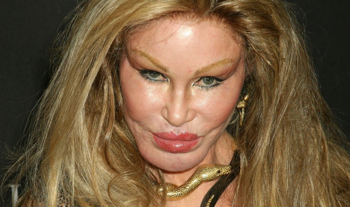 Jocelyn Wildenstein 