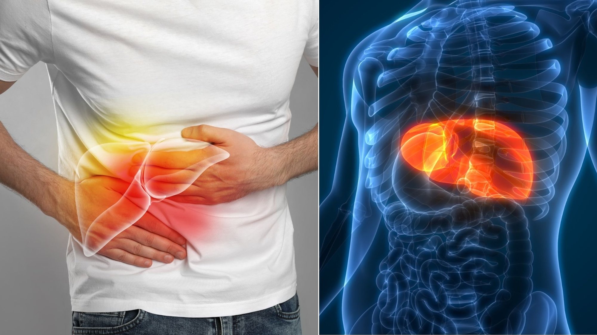 "Healthy" Foods That Silently Harm Your Liver