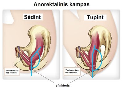 Anorektalinis kampas