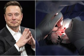 „Neuralink“ smegenų implantą turintis paralyžiuotas vyras demonstruoja neįtikėtinus gebėjimus –  pažiūrėkite, ką jis padarė