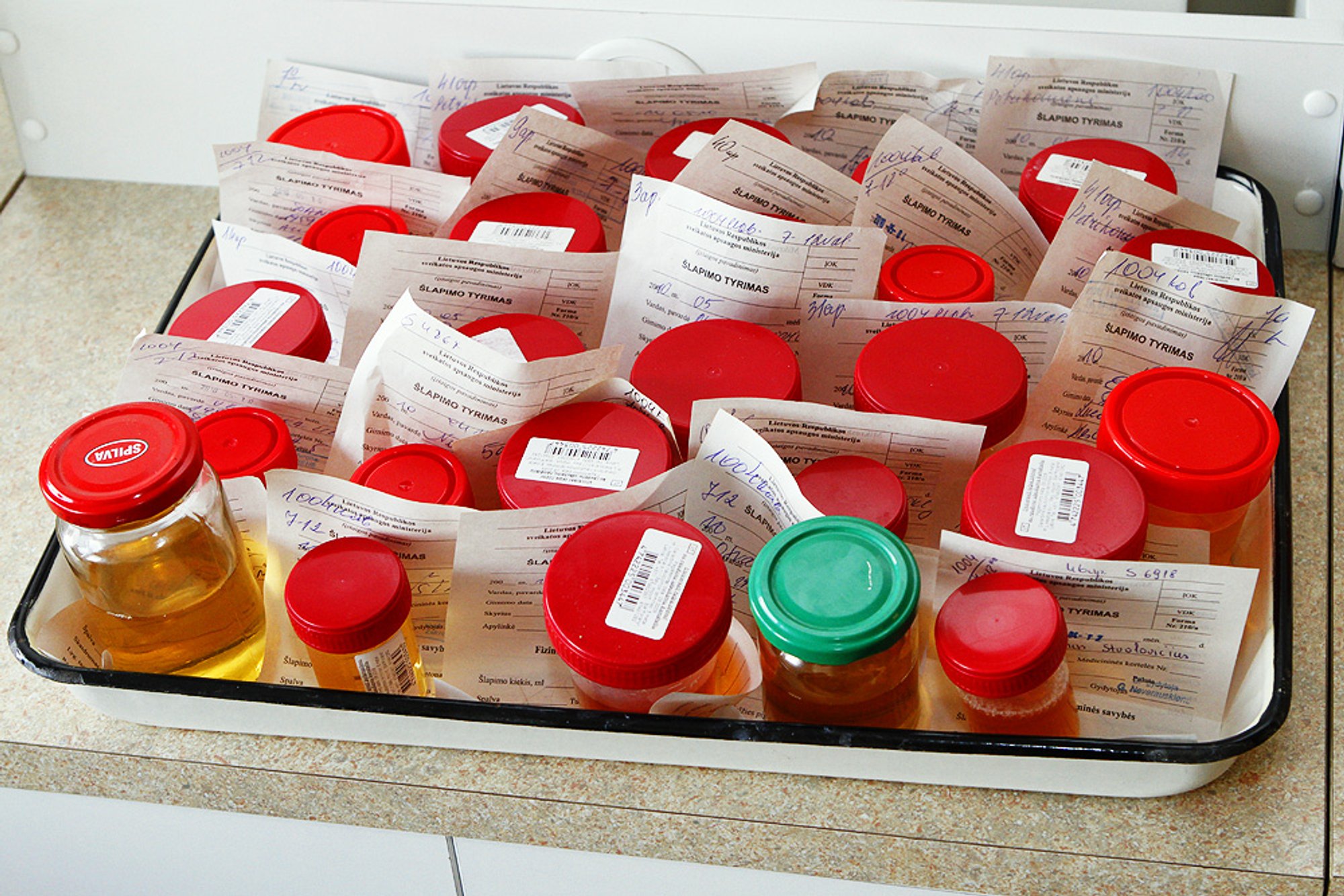 Šlapimo tyrimas gali parodyti žmogaus kaulų būklę - Delfi sveikata