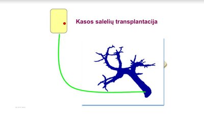 Kasos salelių transplantacija po inksto transplantacijos