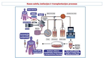 Kasos salelių transplantacija po inksto transplantacijos