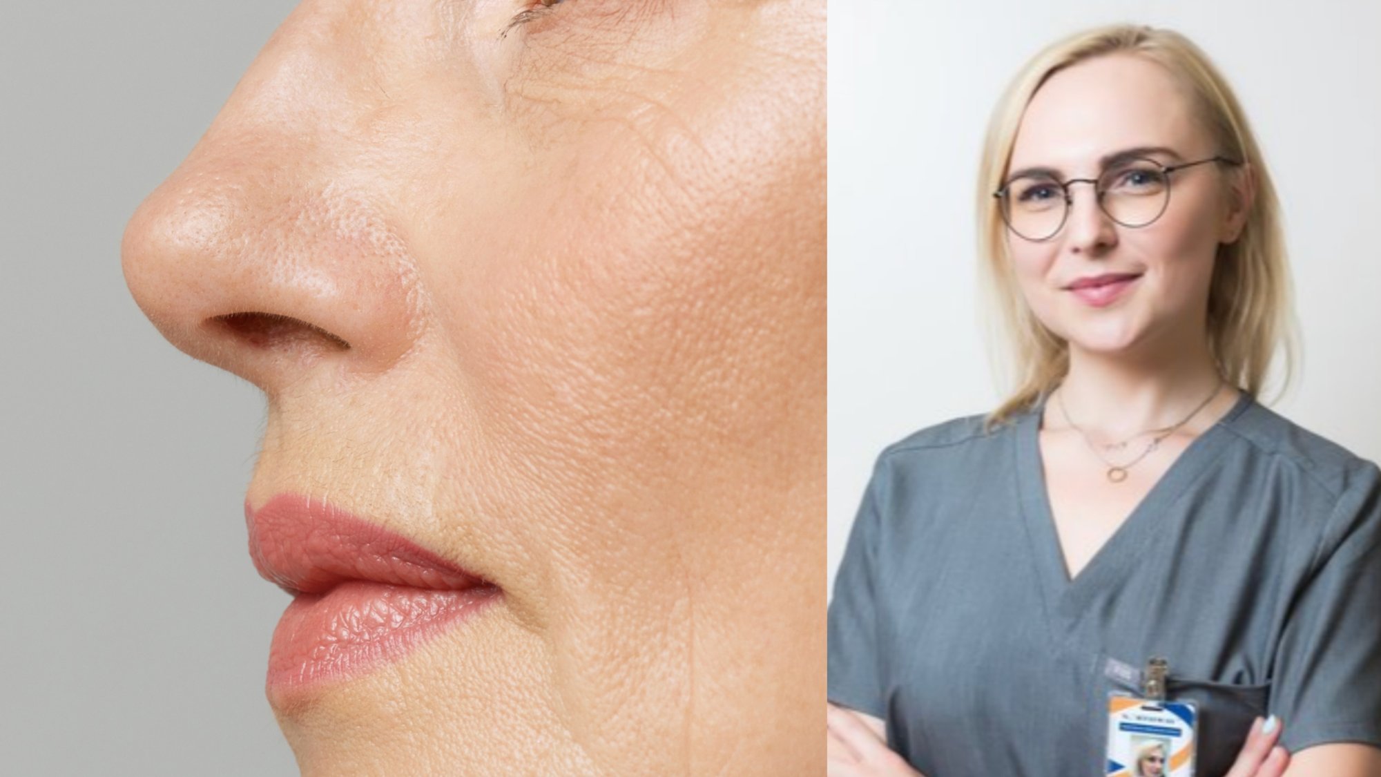 Medikė pasakė, kuo susiję nosis ir greitesnis senėjimas: signalai, kurių negalima ignoruoti