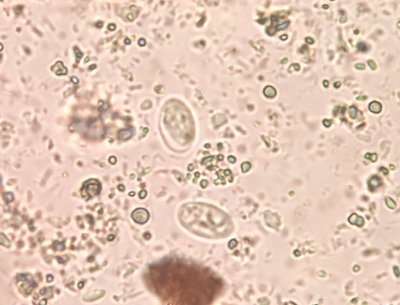 Giardia lamblia