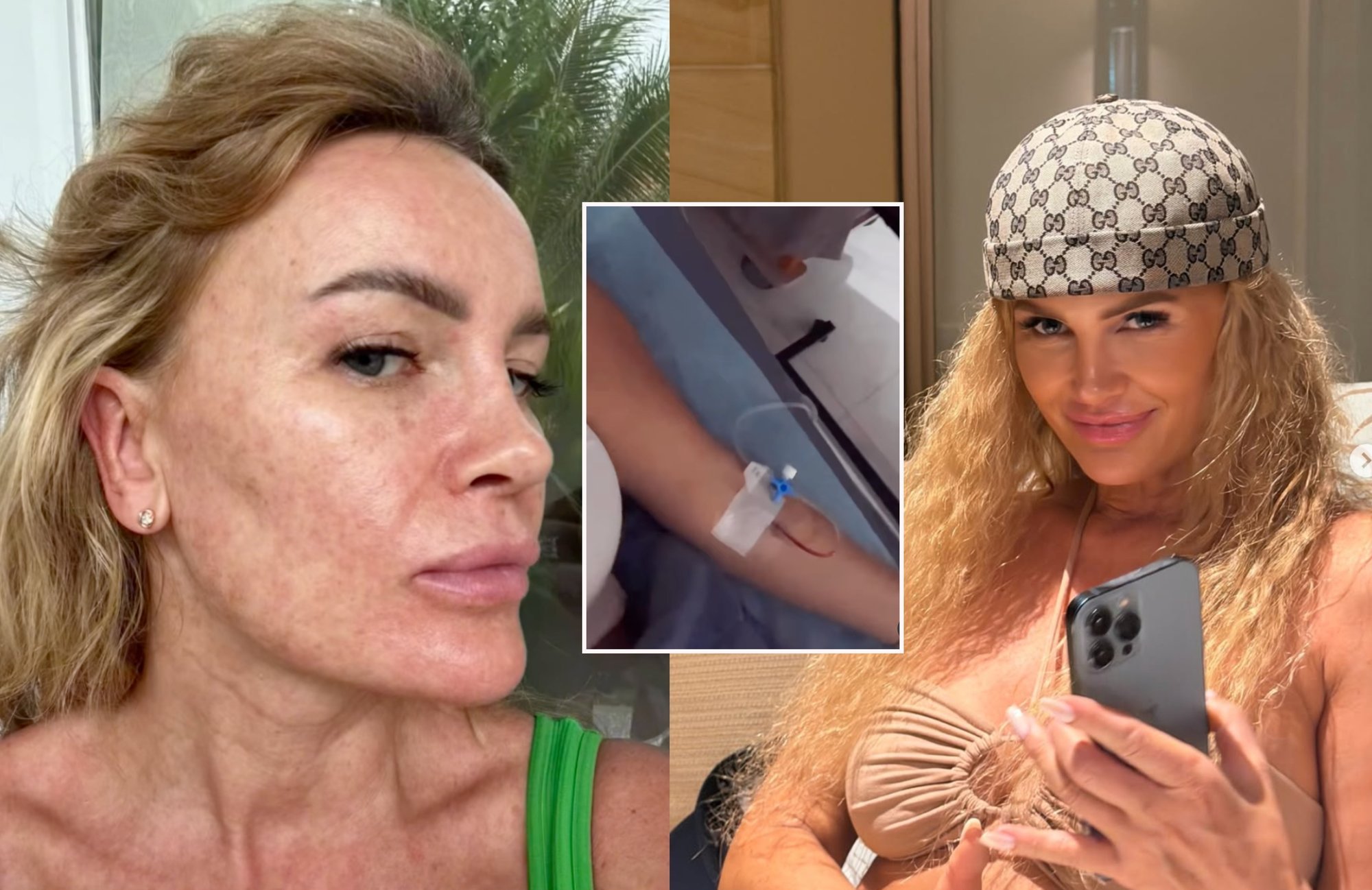 Lithuanian abroad faces health scare with mysterious full-body rash