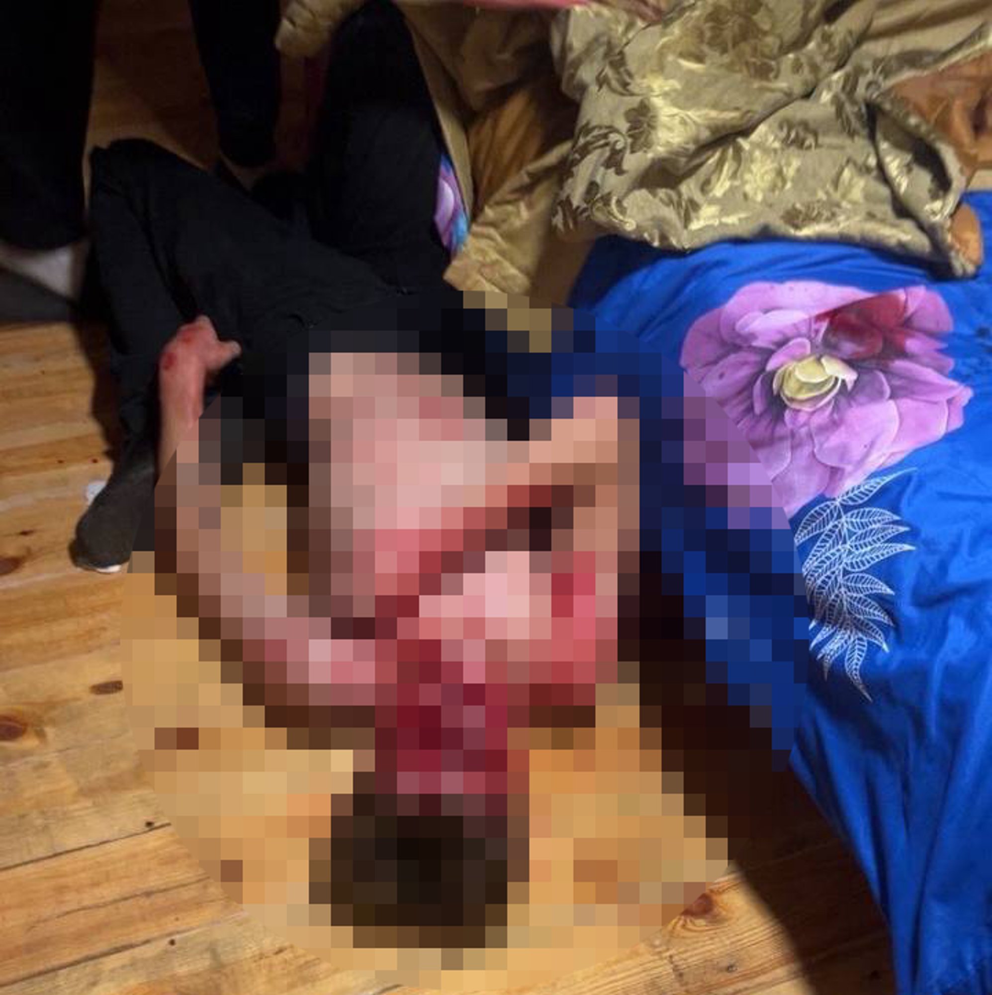 Young man severely beaten at Lithuanian party; MMA fighter allegedly involved