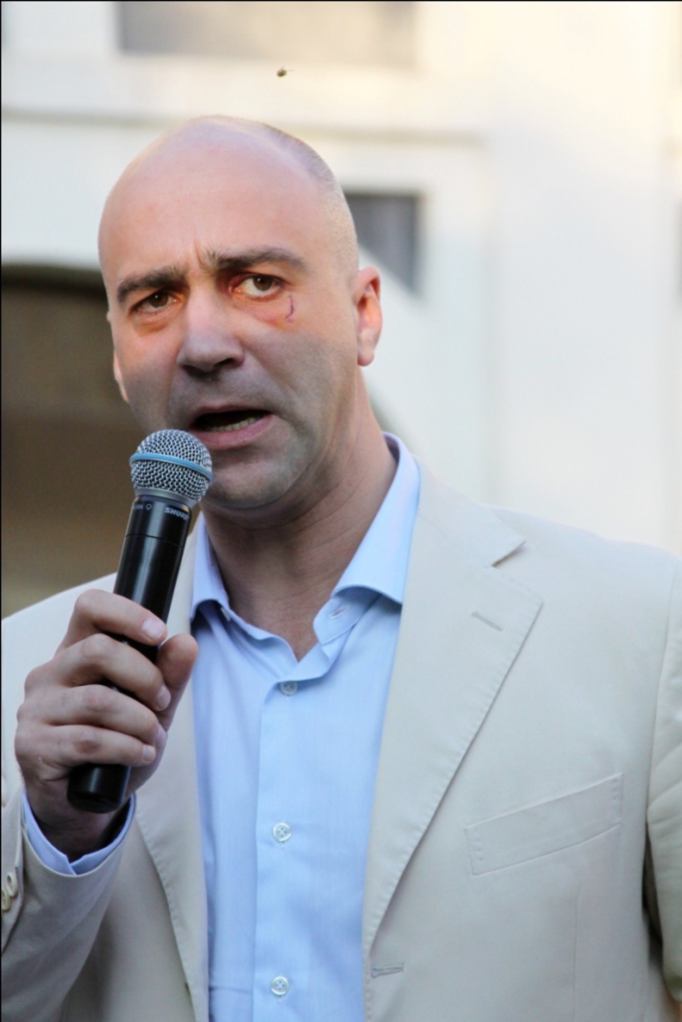 Algio Greitai veidą „papuošė“ prakirstas paakys - Delfi veidai