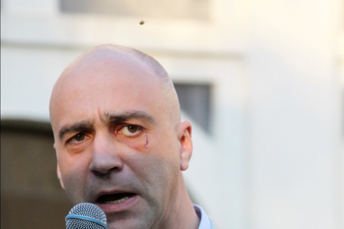 Algio Greitai veidą „papuošė“ prakirstas paakys - Delfi veidai