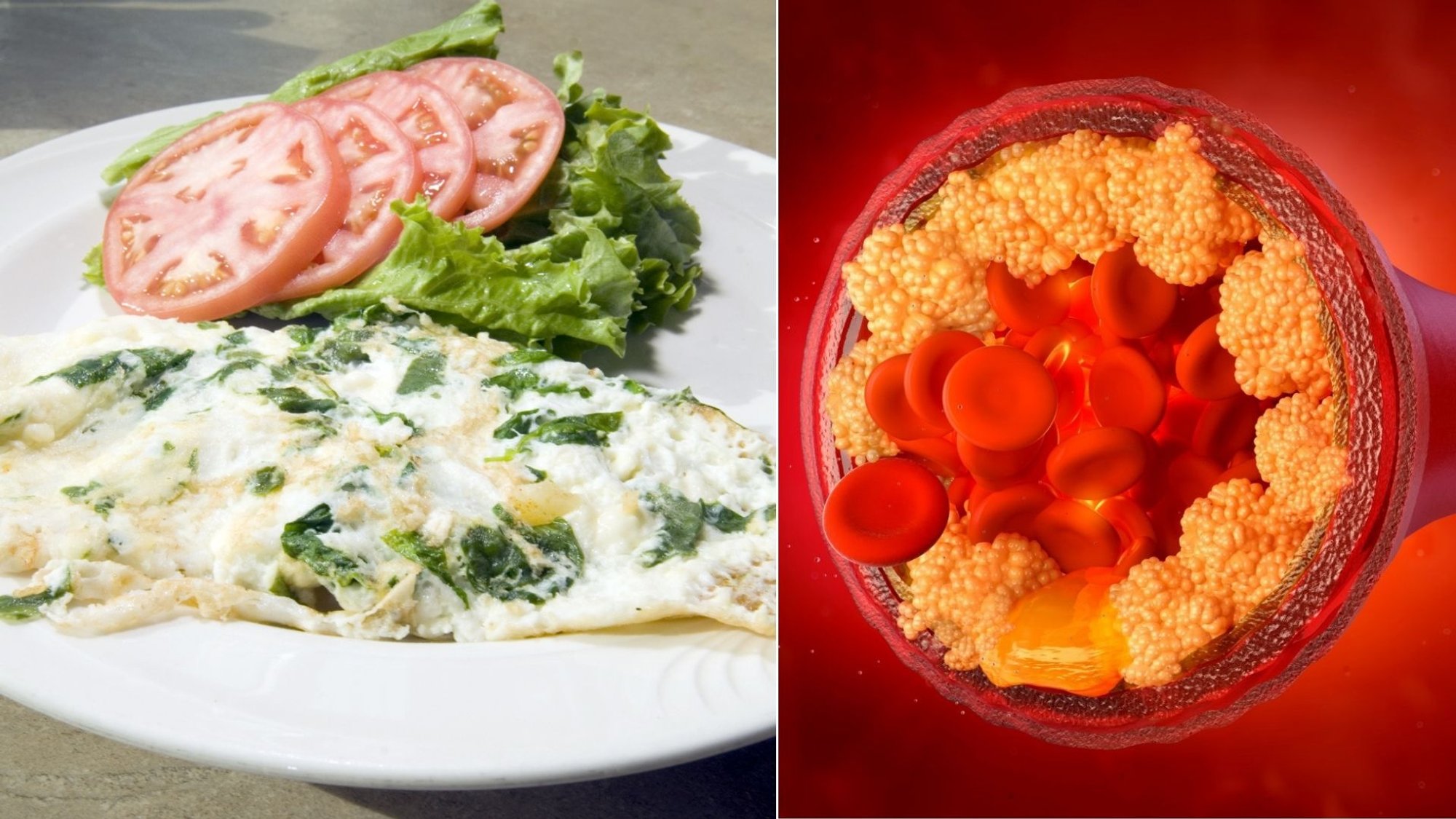 Popular breakfast item linked to reduced bad cholesterol, study finds