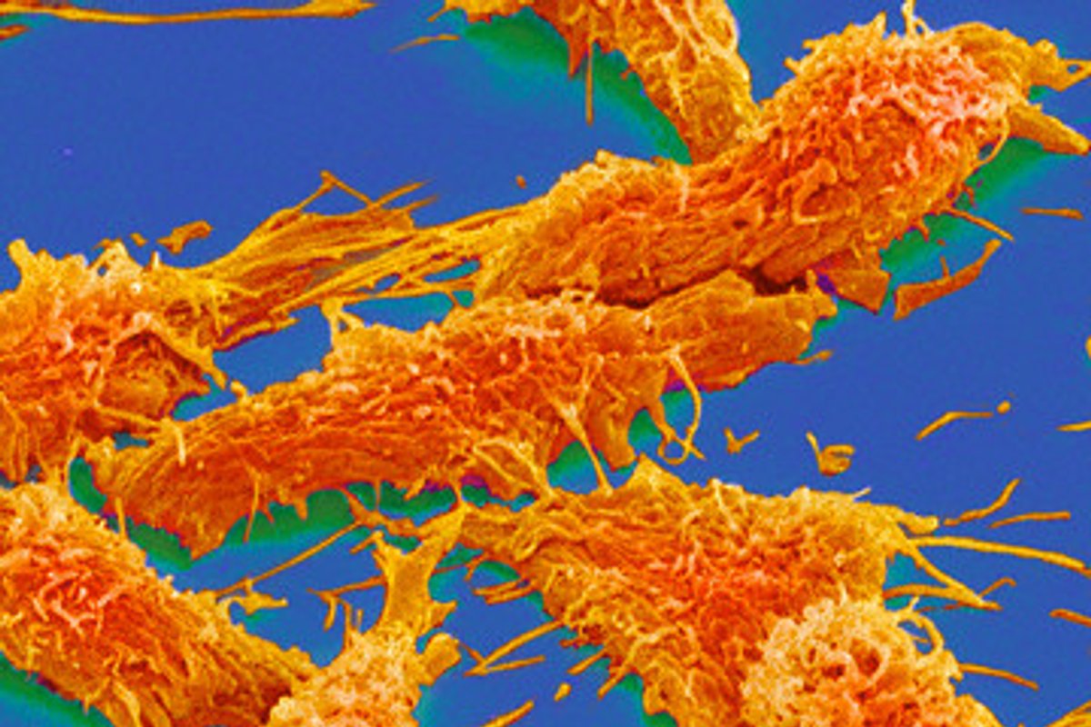 Vėžys – ne liga, o nauja besivystanti rūšis? - Delfi mokslas