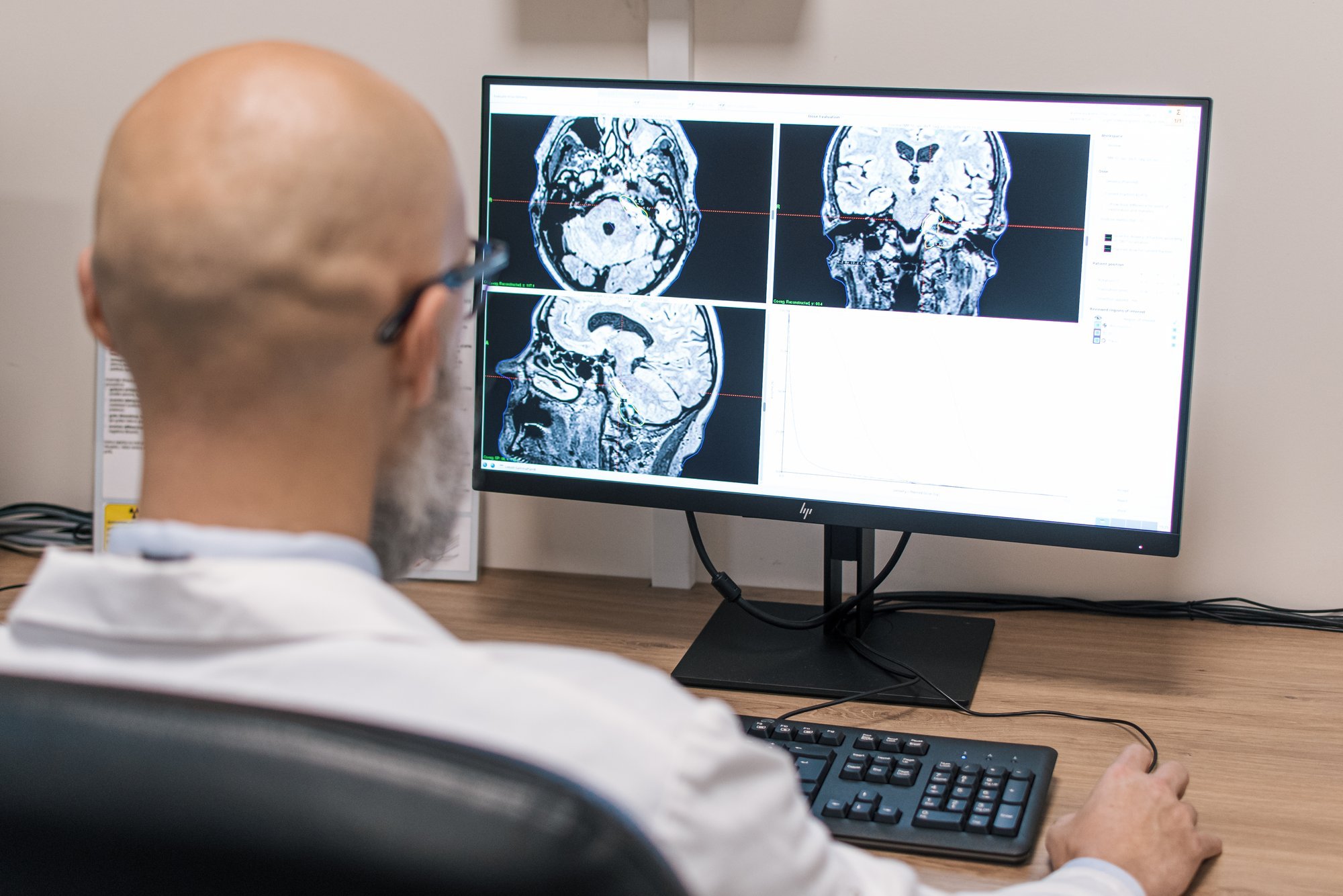Lithuania's Sole Gamma Knife Center Completes 2,000 Advanced Brain Surgeries