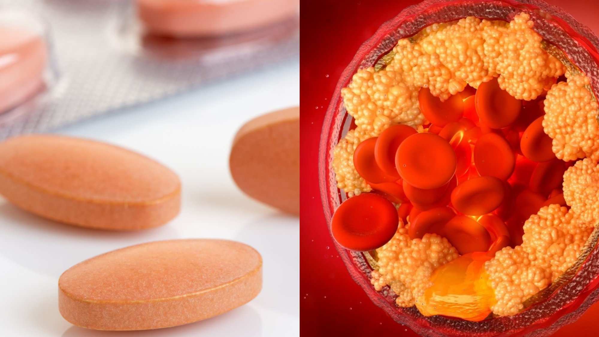 New study finds statins safer than previously believed