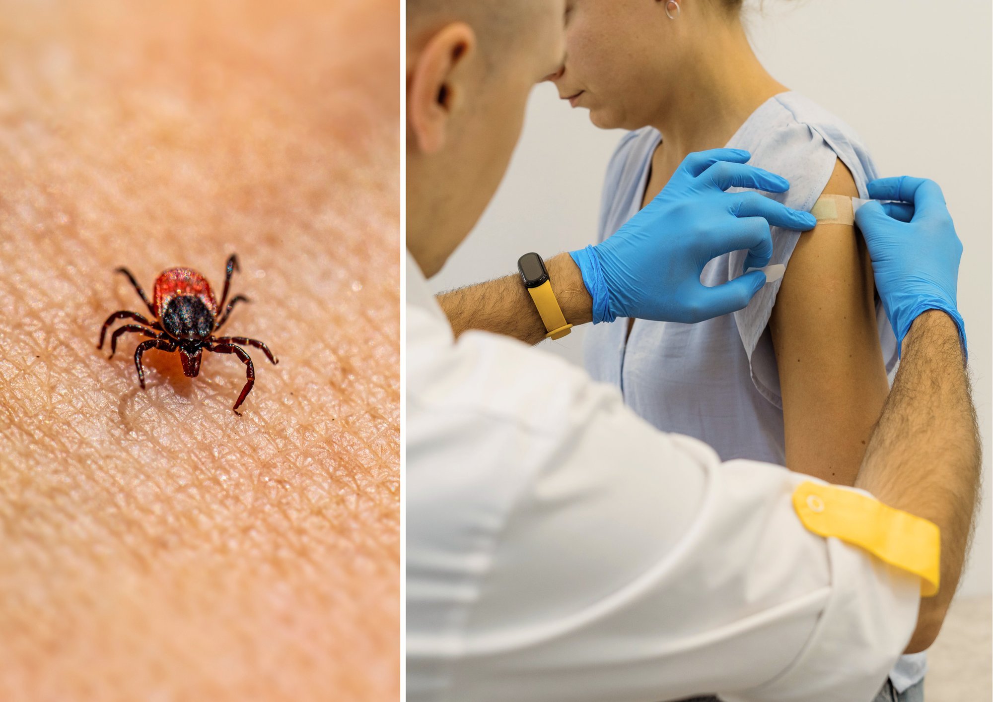 Lithuanian Pharmacist Warns of Common Mistakes in Tick-Borne Disease Prevention