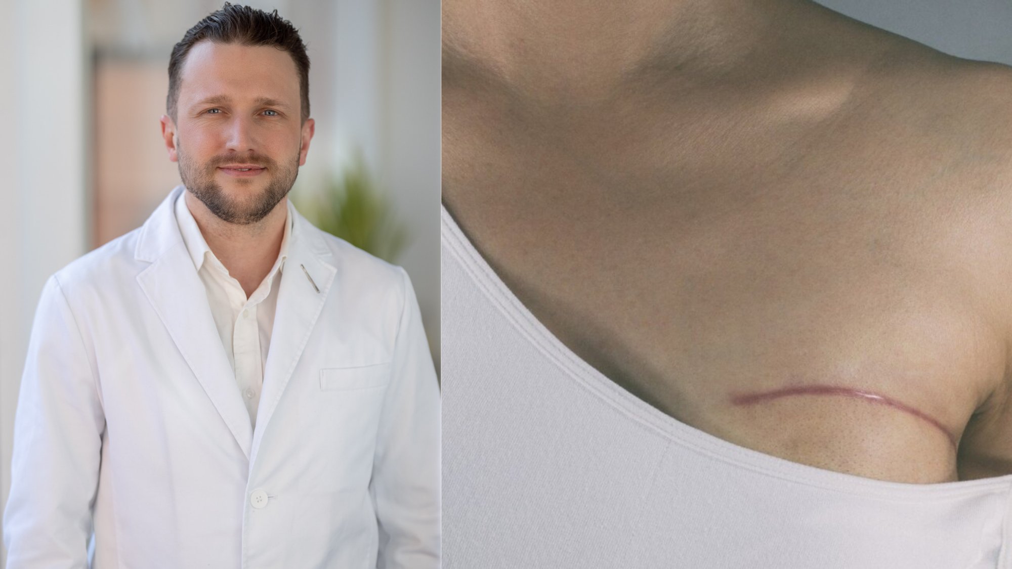 Doctor Explains What You Need to Know About Breast Reconstruction After Cancer