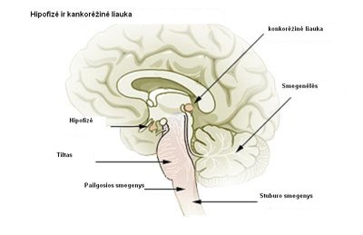 Hipofize_ir_kankorezine_liauka