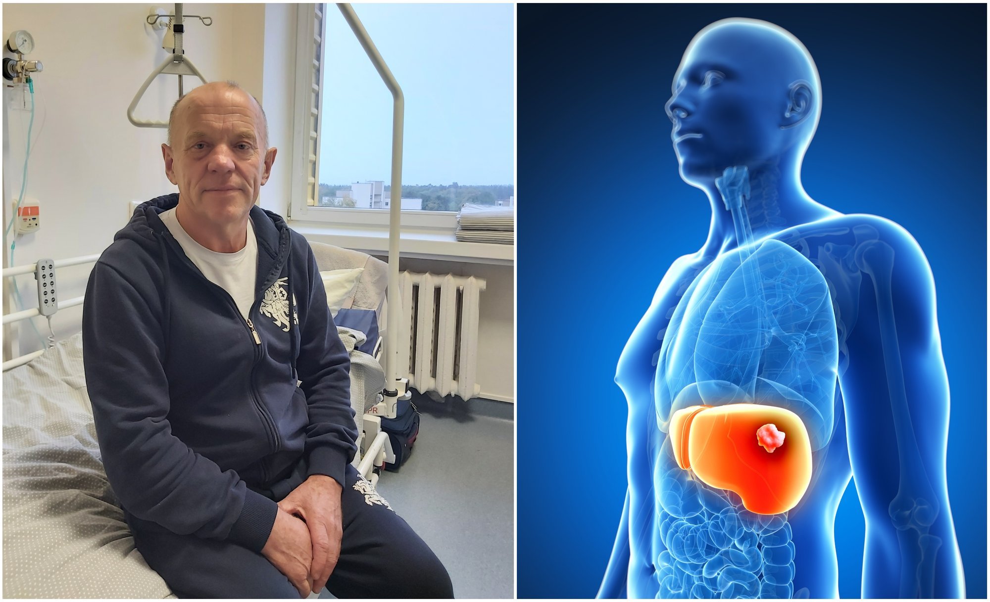 Užvalgiusį sriubos Joną nutvilkė stiprus dieglys – atlikus tyrimus ...
