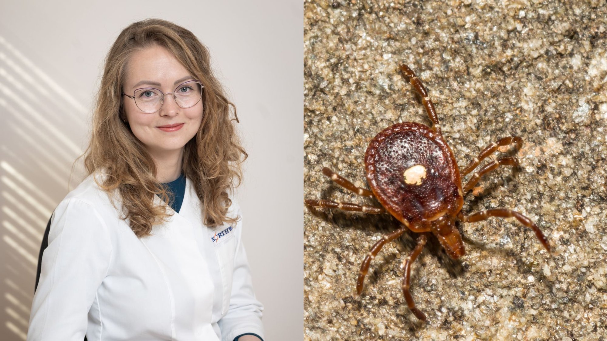 Tick Season Isn't Over: Doctor Explains When Immunity Forms After Vaccination