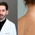 Gydytojas Andrius Jurėnas įspėja: šie 5 požymiai gali reikšti odos vėžį 