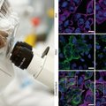 Mokslininkai praneša atradę virusų Achilo kulną – pradės kurti naujos kartos antivirusinius vaistus