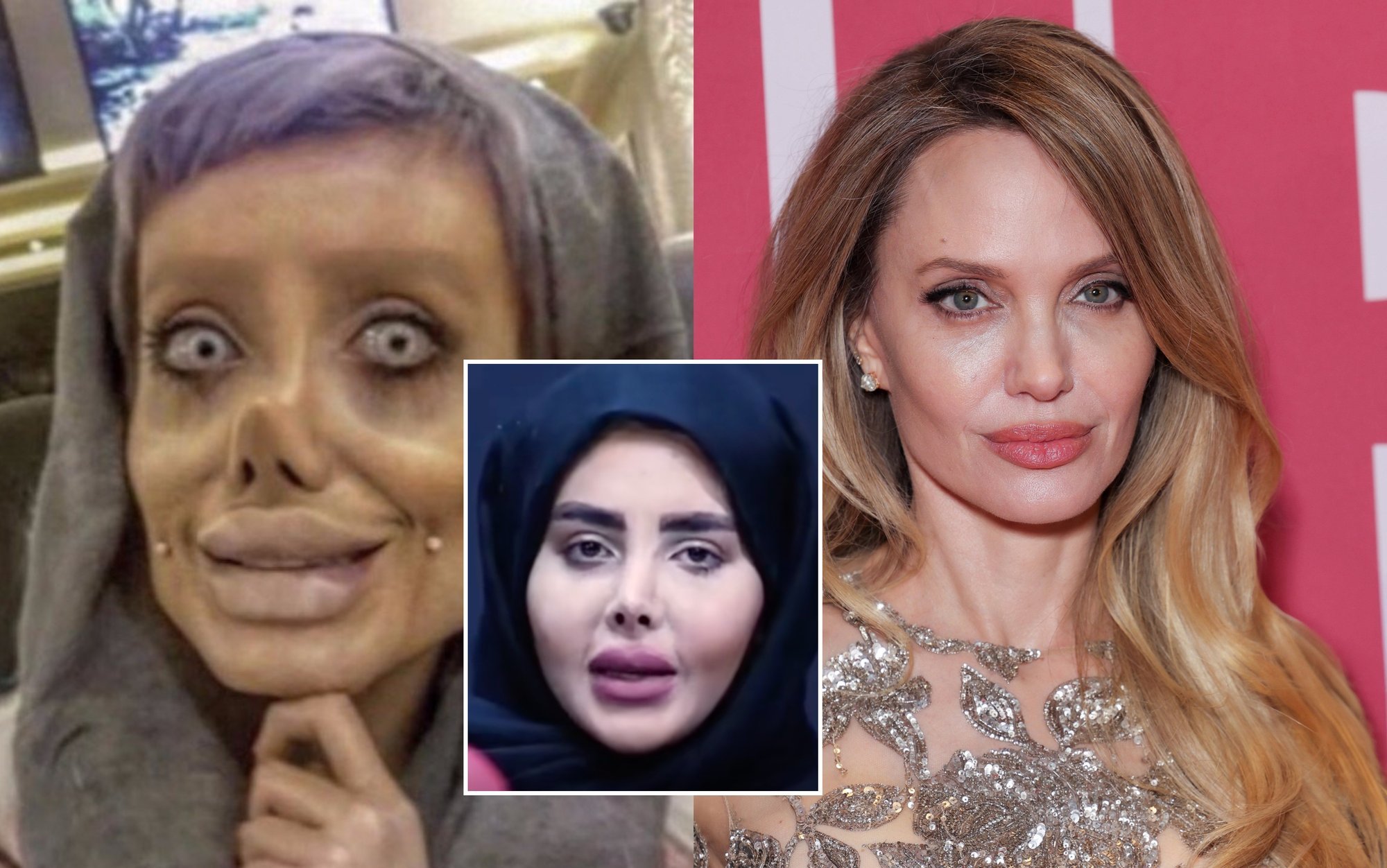 Iranian woman known as 'zombie Angelina Jolie' looks unrecognizable in resurfaced video