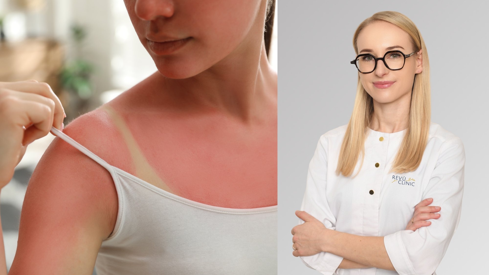 Dermatologist Warns Popular Sunburn Remedies May Worsen Skin Damage