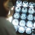 Net pusės Alzheimerio ligos atvejų galima išvengti, saugantis 14 rizikos veiksnių