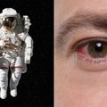 Iš kosmoso grįžusių astronautų akyse – reikšmingi pakitimai: kas nutinka akies obuoliui ir regėjimui? 