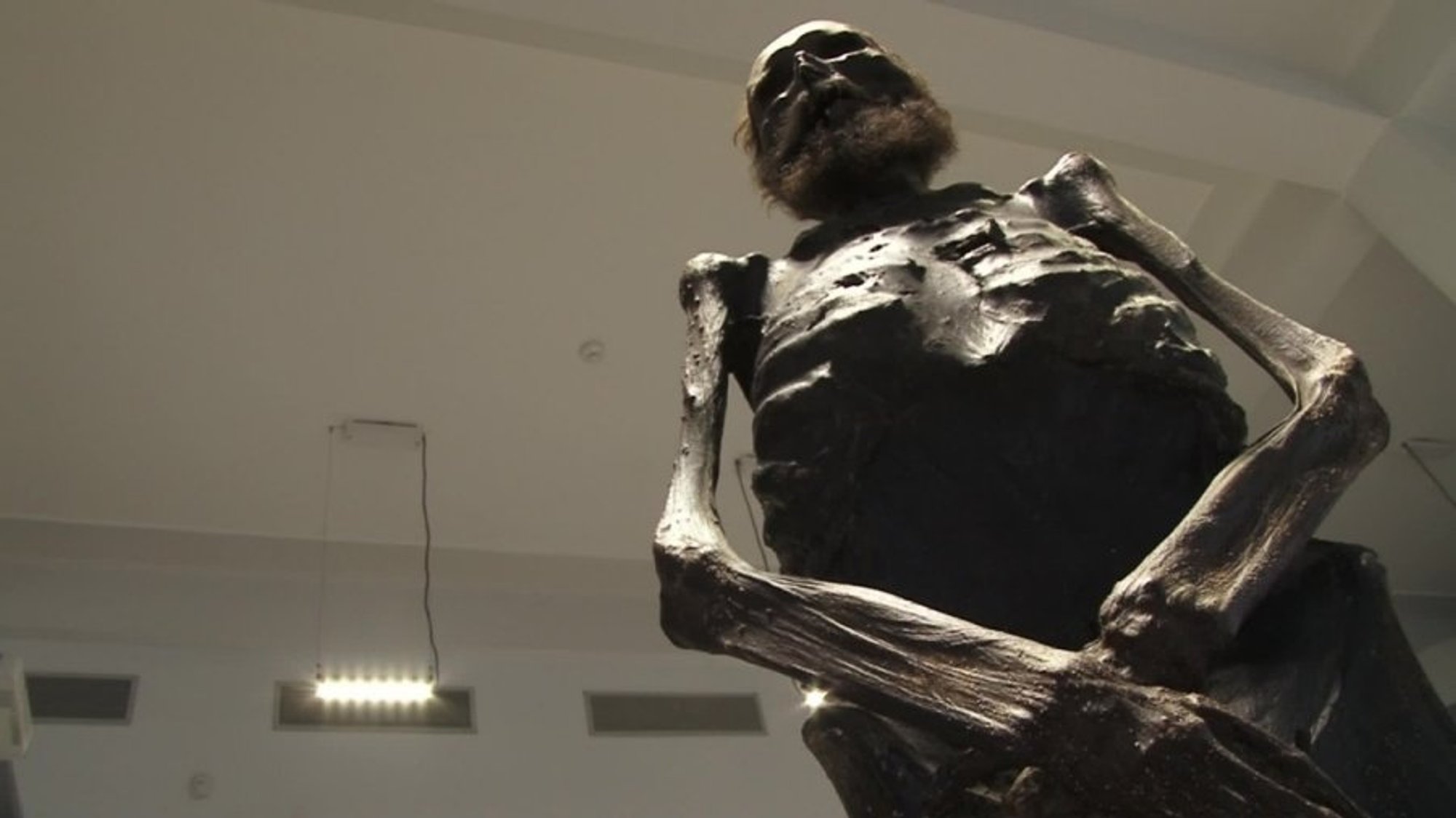 Mokslininkai ketina atskleisti VU Medicinos fakultete saugomos mumijos ...