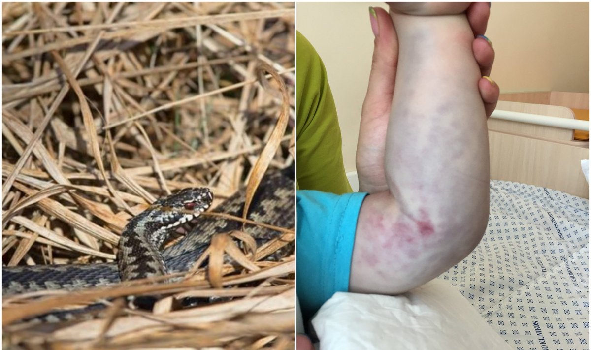 В детском саду ребенка укусила змея - Delfi RU
