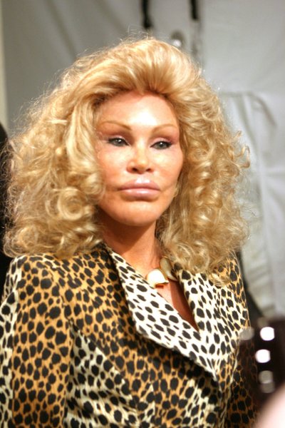 Jocelyn Wildenstein