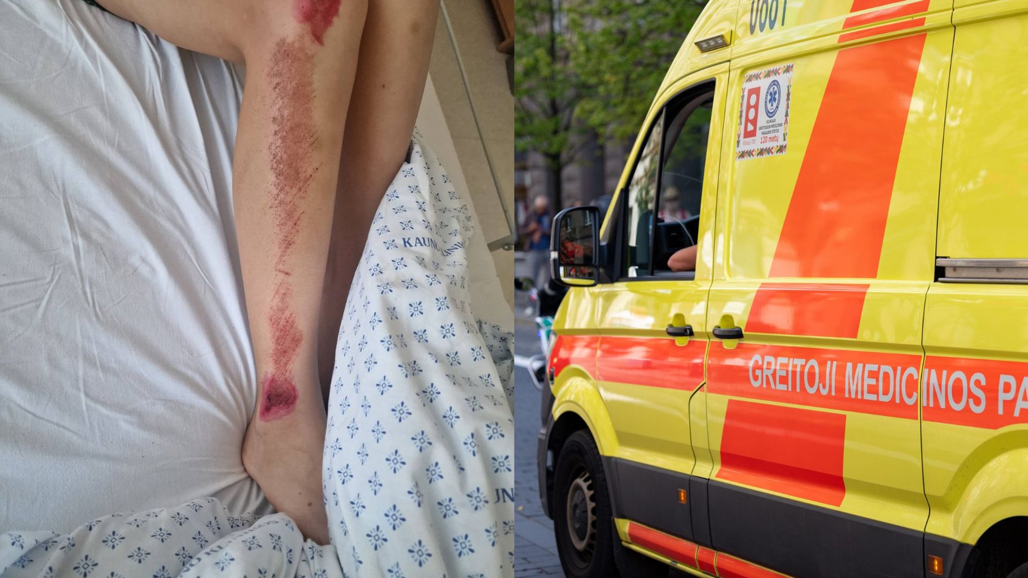 Lithuanian Mother Recounts Son's Severe Electric Scooter Injuries, Calls for Caution