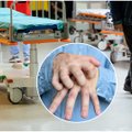 Kauno rajono gyventojams nerimą sukėlė parazitinė liga: pirmieji požymiai gali pasimatyti po kelių savaičių