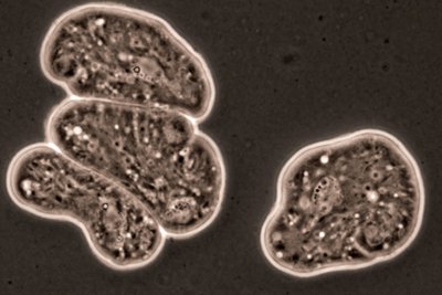 Entamoeba histolytica 