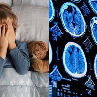Vaikų neurologė – apie vieną tėvų klaidą: kada tai veda prie emocijų raidos problemų ir net depresijos