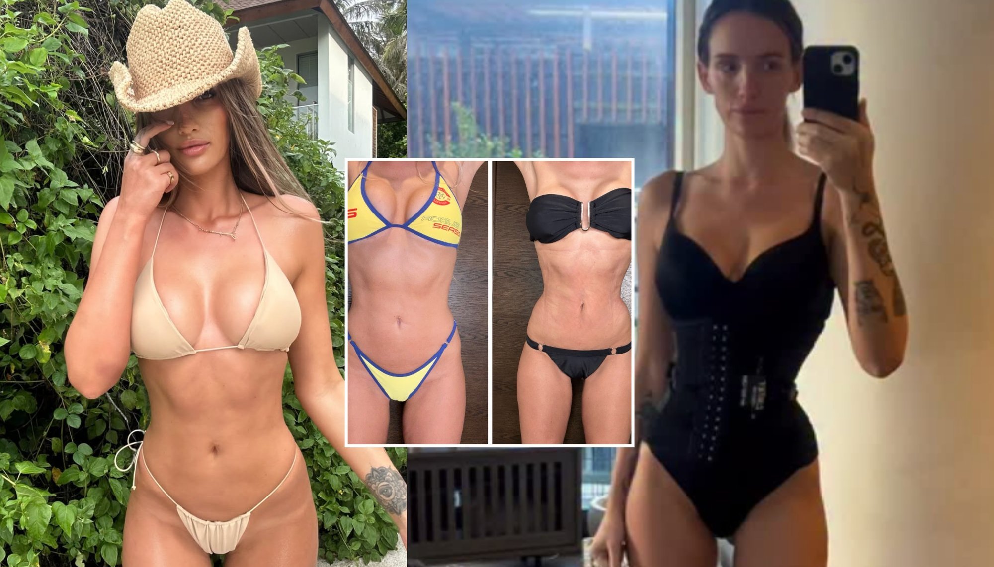 Reality Star's Rib-Shaping Procedure Sparks Heated Debate Online